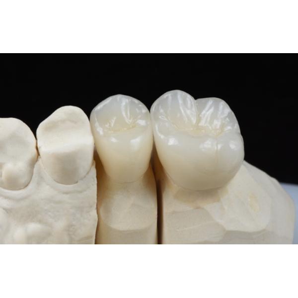 1200 Mpa High Translucent Dental Zirconia B1 98*25mm Open System