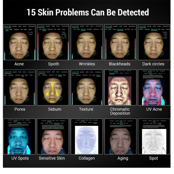 Upgrade Facial Care Skin Analyzer Face Detector 3D New Model Face Skin Analyzer Scanner Device Aesthetics in 17 Languages