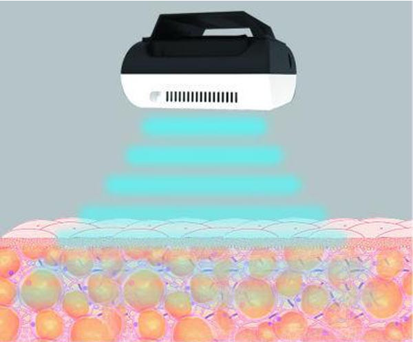 Портативное тело кавитации уменьшая красоту машины 40к Рф уменьшая оборудование