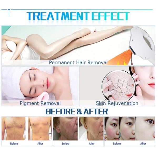 Professional SHR Hair Removal Machine , E - Light IPL Beauty Machine