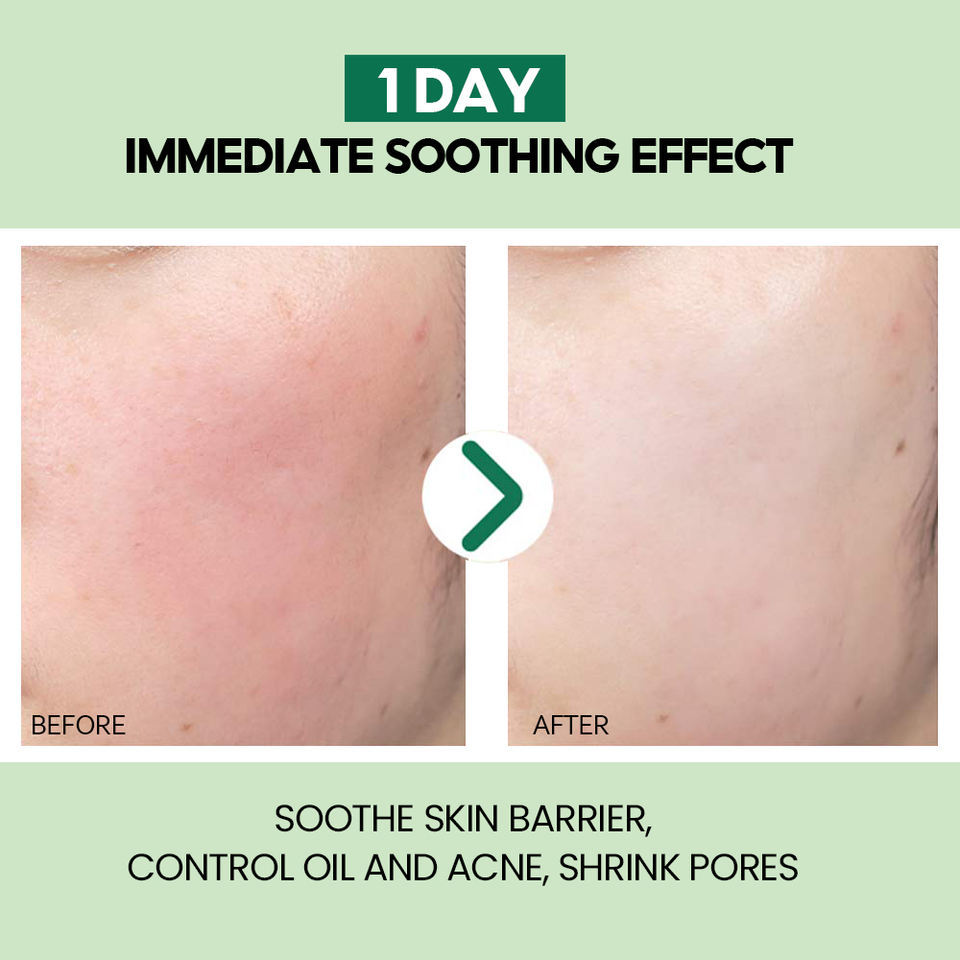 OEM ODM Korean Organic Facial Skin Care essence Facial Soothing Anti aging Aloe Vera Skin Care Product Facial Anti wrinkle Serum