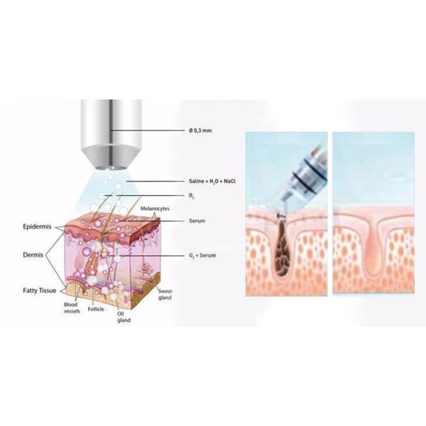 5 Handles Facial Oxygen Jet Peel Beauty Equipment Facial Oxygen Therapy Machine