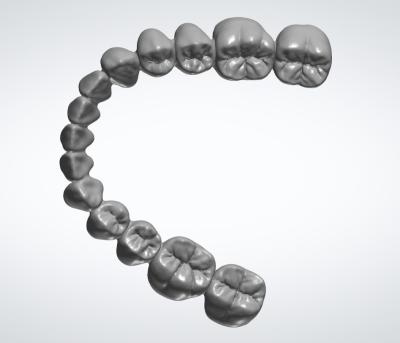 Restoration EXO Dental Design Service Dental Brace Crown Dental Interior Design
