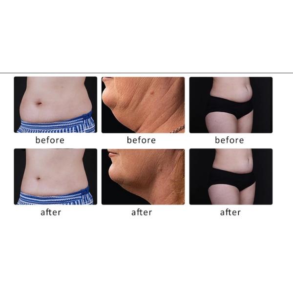 Машина Крйо жирная замерзая Крйолиполысис 360 градусов для высокой эффективности потери веса