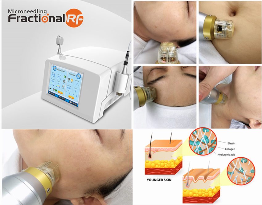 машина частичной RF глубокой жары 4 рук красоты Microneedling лицевая