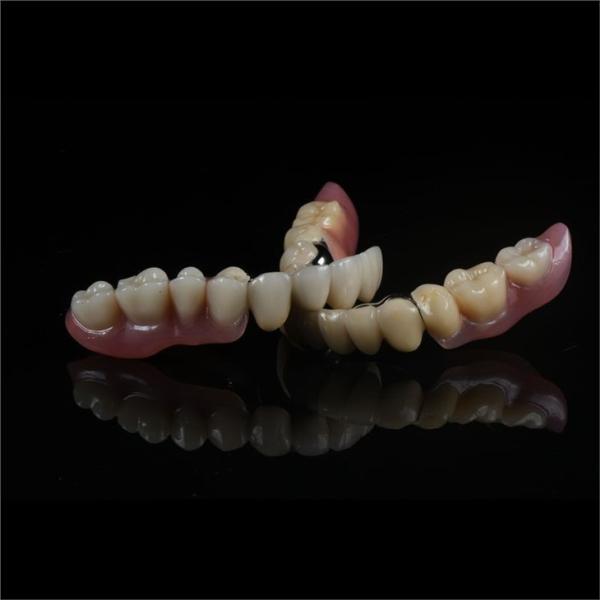 Precision Zirconia PFM Crowns Partial Dentures Natural Looking