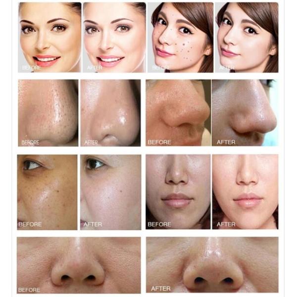 Забота кожи 4 корки двигателя кислорода в 1 машине красоты