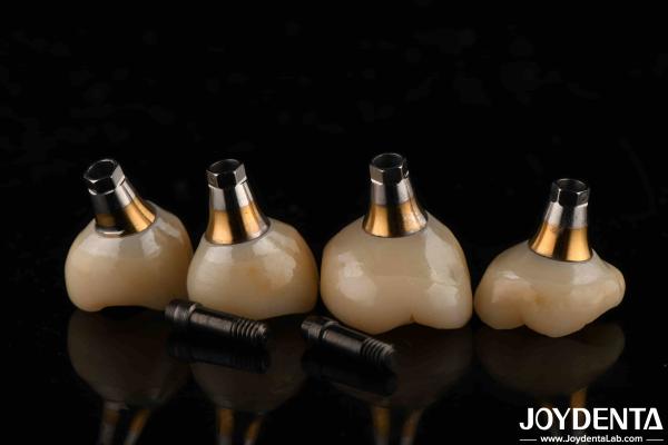 4.1mm Diameter Titanium Dental Finished Abutments Silver With Thread Pitch 1.5mm