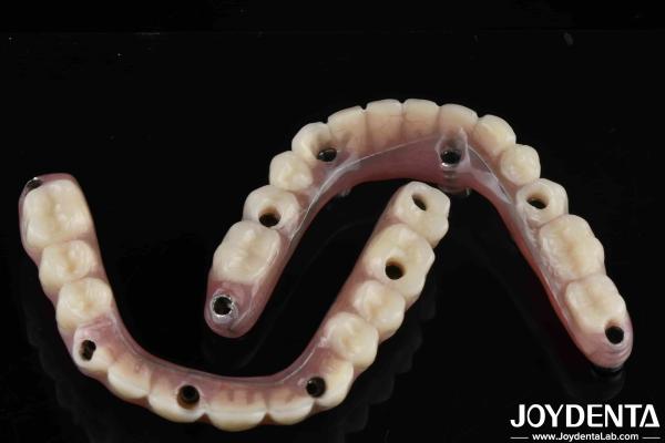 Natural Look Dental Laboratory Acrylic Teeth Finish For High Wear Resistance