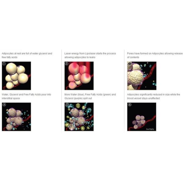 Portable Weight Loss 635 - 650 Nm Lipo Laser Slimming Machine Professional