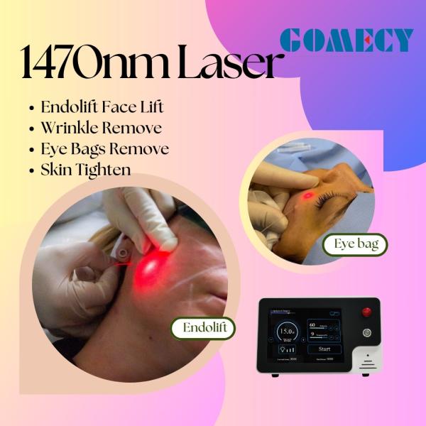 プロ 1470nm エンドリフトレーザー 顔リフティングと歯科軟組織切断