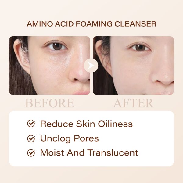 Niacinamide Foam Cleanser Whitening Anti-acne Face Wash Cosmetic Skin Care Oil Control Amino Acid Firming Cleanser