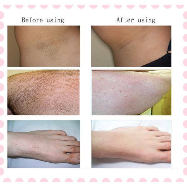 Multifunction Permanent IPL Hair Removal Machine For Beauty Salon