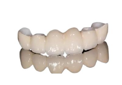 Corrosion Resistant Porcelain Dental Crown Natural Appearance For Front Teeth / Back Teeth