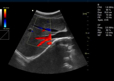 Professional Color Doppler Machine Ultrasound Scanner Equipment With Software Packages