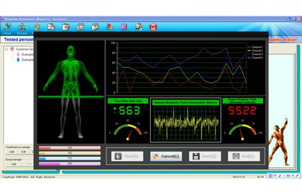 38 Reports Quantum Magnetic Therapy Machine ，Body Composition Analyzer