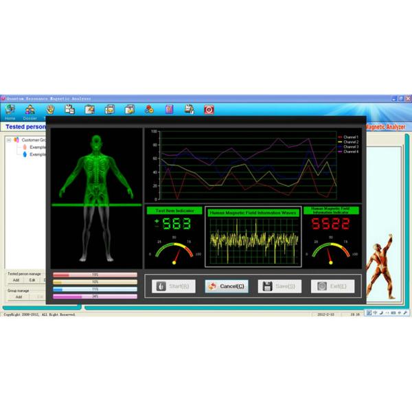 Quantum Health Test Machine French , Body Elements Analyzer Malaysia