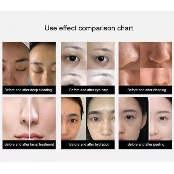 14 In 1 Peeling Hydro Microdermabrasion, Oxygen Jet Aqua Care, Deep Cleansing And Moisturizing Skin, Removes wrinkles