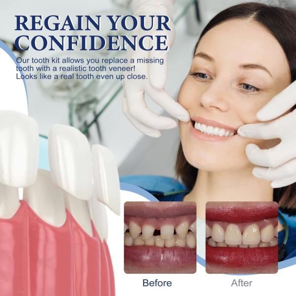 Temporary Tooth Repair Kit Moldable Natural Shade Filling For Missing Or Broken Teeth