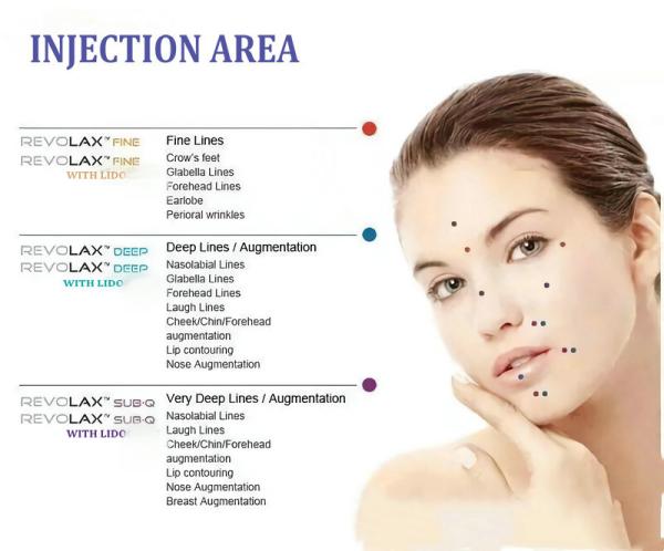 Revolax Hyaluronic Acid Lip Injections 1.1ml