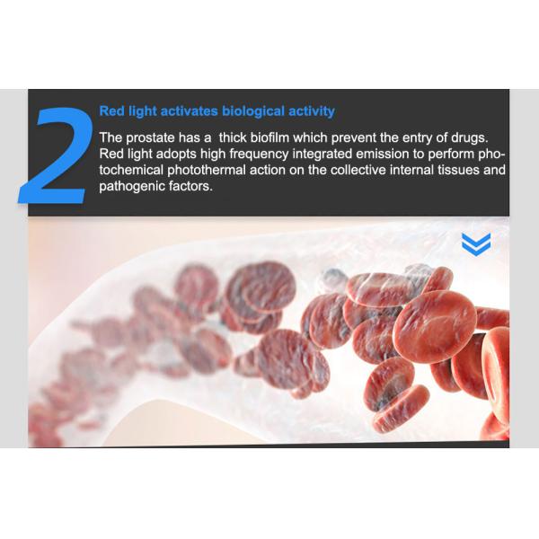 Прибор терапией облегчения боли Unisex простаты и тазовой полости