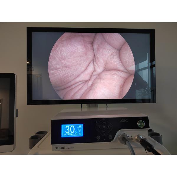 Monitor médico endoscópico de alta definición de 32 pulgadas 4K UHD para cirugía