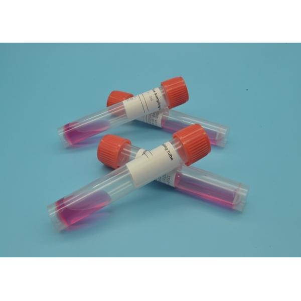 Sample Collection Universal Viral Transport Kit With Collection Swab