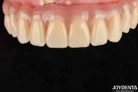 Fast Drying 5 Minutes Acrylic Teeth Finish For Dental Tooth Restoration