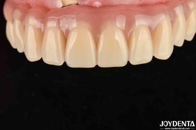 Fast Drying 5 Minutes Acrylic Teeth Finish For Dental Tooth Restoration