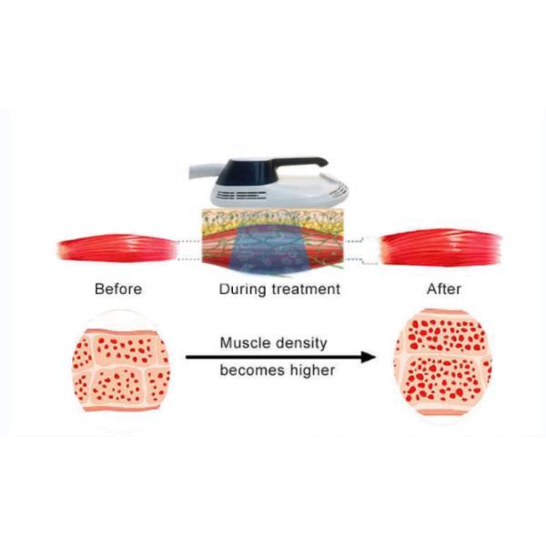 4 Handles EMS Slimming Rf Machine Reduce Fat Build Muscle Skin Tightening