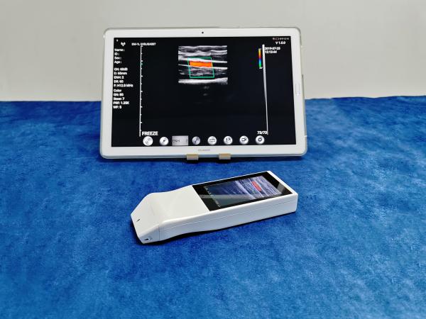 Wireless Linear Array Ultrasound Probe Handheld Wifi Ultrasound Scanner Price for Sale