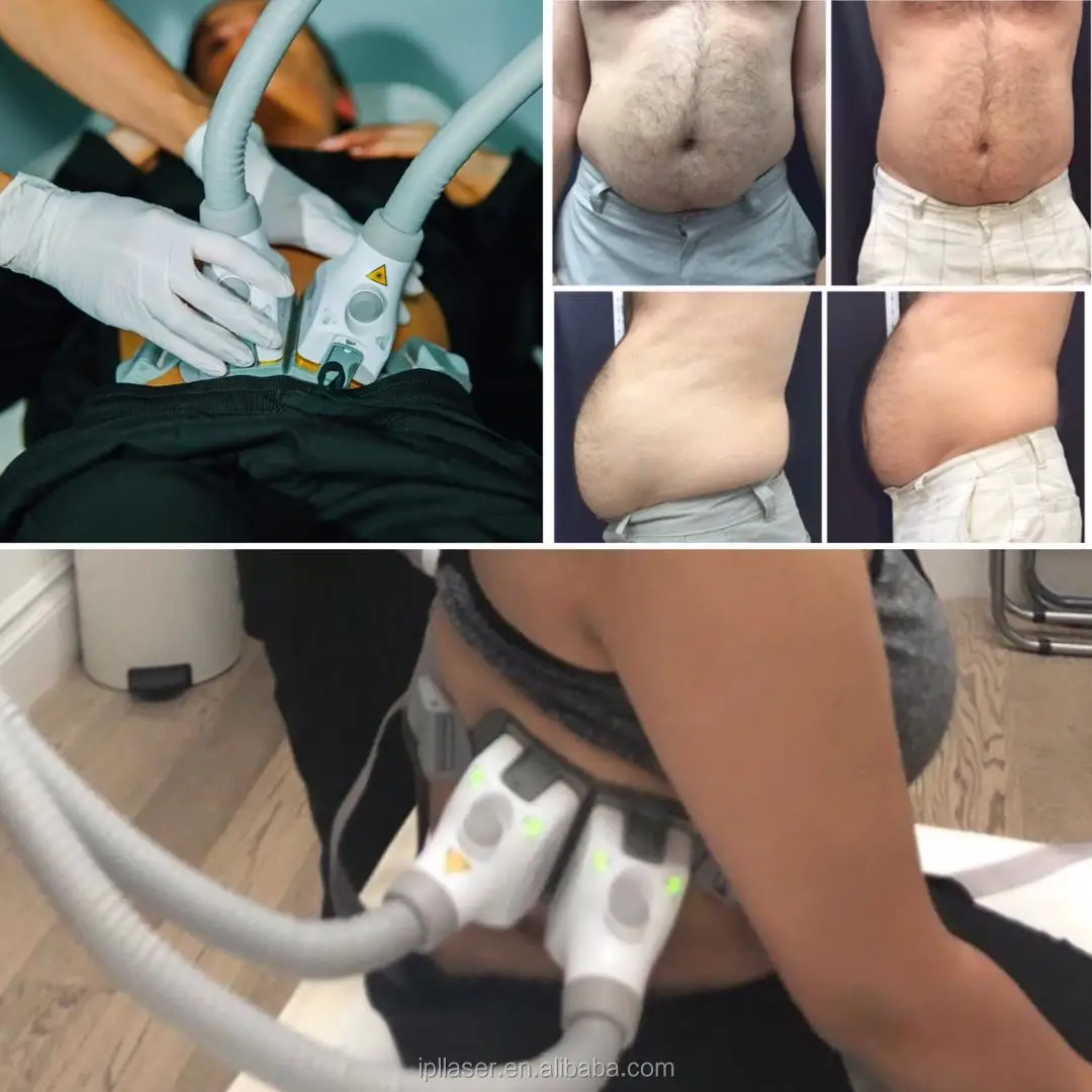 1060nm diode laser sculpsure body contouring fat freezing slimming system for fat loss