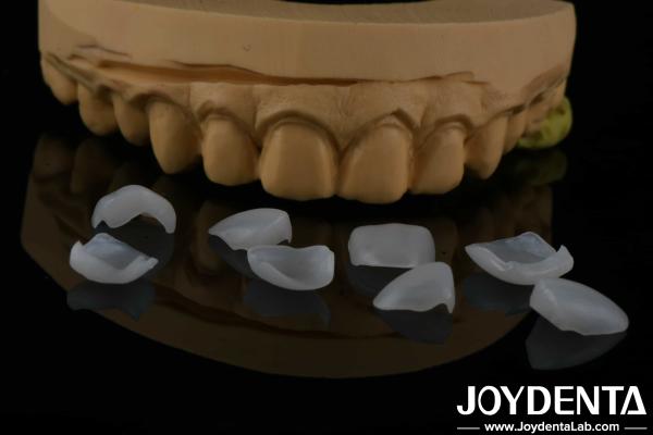 Natural Appearance Glass Ceramic Veneers , Dental Clinic Veneers Strong Bond