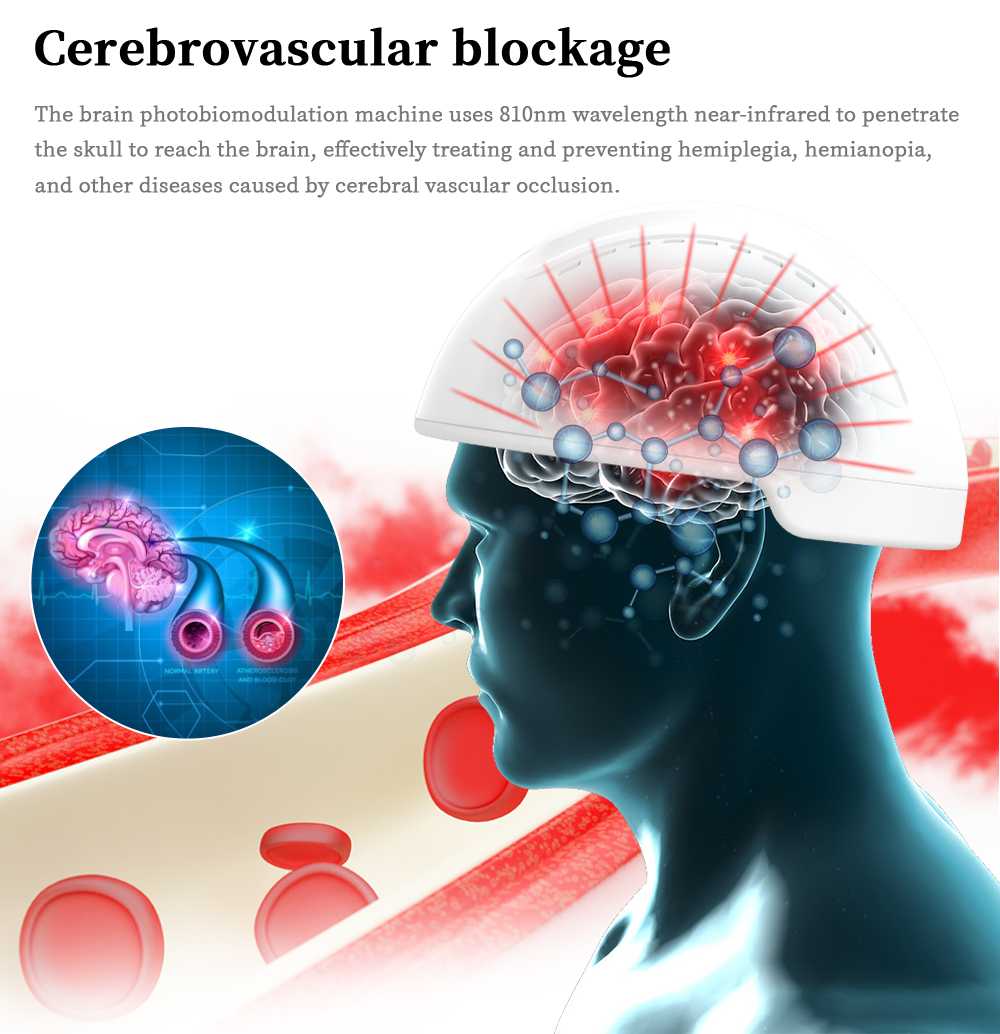 Терапия красного света Rejuvenate шлем Photobiomodulation мозга
