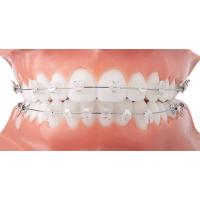 Beaux appareils orthodontiques fixes de parenthèse en céramique orthodontique propre facile