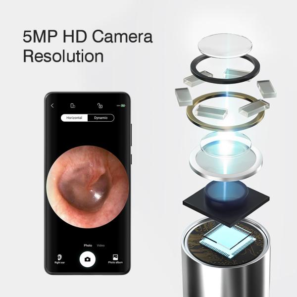 Electric Earwax Remover with Wireless Otoscope Camera and Rechargeable Battery