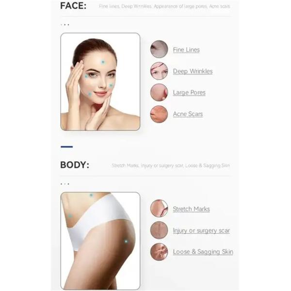 Портативная машинка 2 в 1 частичной машине Rf Microneedling с холодным молотком
