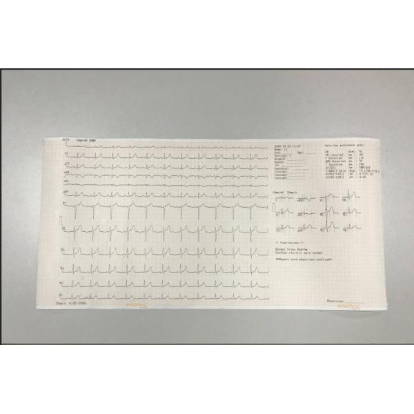 Gray Handheld Medical Equipment Portable ECG Machine SE1200lite 12 Channel