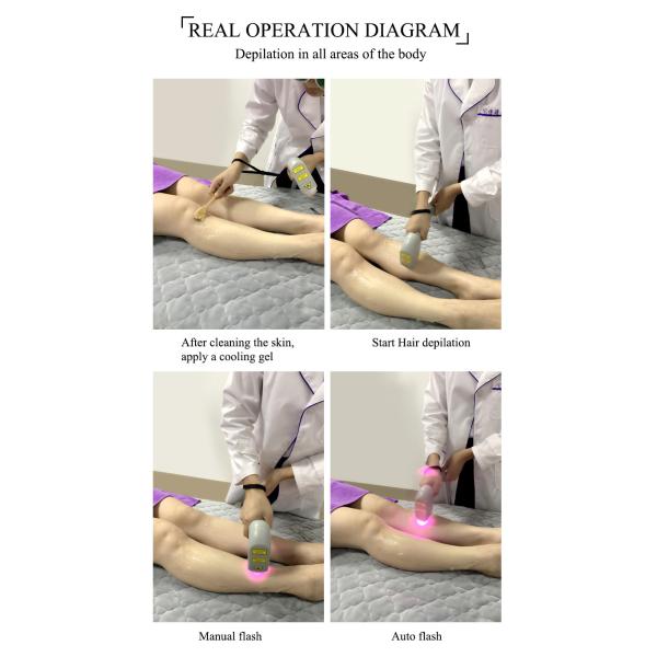 Ultra Effective Diode Laser Hair Removal System With Cooling And FDA Clearance