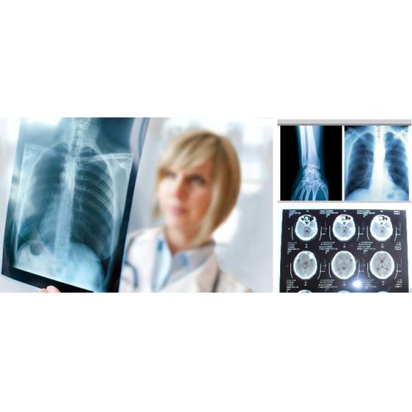 Фильм печатания фильма рентгеновского снимка радиологии голубой струйный медицинский водоустойчивый струйный