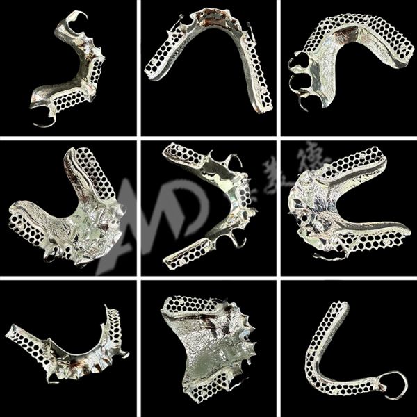 Custom Cast Partial Denture Dental Prosthetic Framework Without Teeth Set Up for Stability And Function