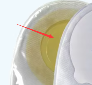 New Arrival Wholesale Price Colostomy Bag Medical One Piece Urostomy Bag Pouch of Stoma