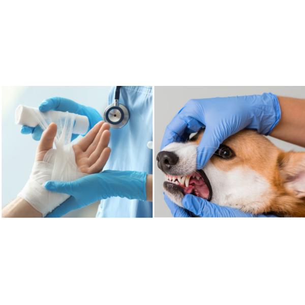 Odorless Disposable Medical Gloves Nitrile Powder Free Gloves