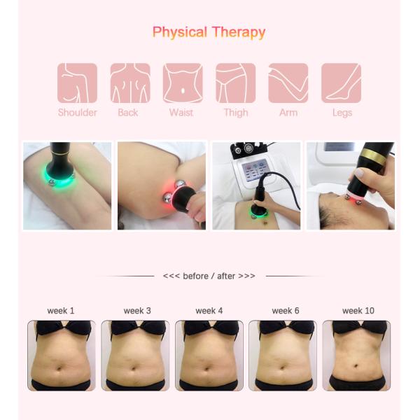 Тело кавитации машины терапией вакуума подниматься стороны RF ультразвуковое уменьшая прибор