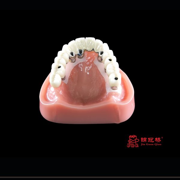 Dental Implants Restoration Dental Zirconia Screw Crown Implant
