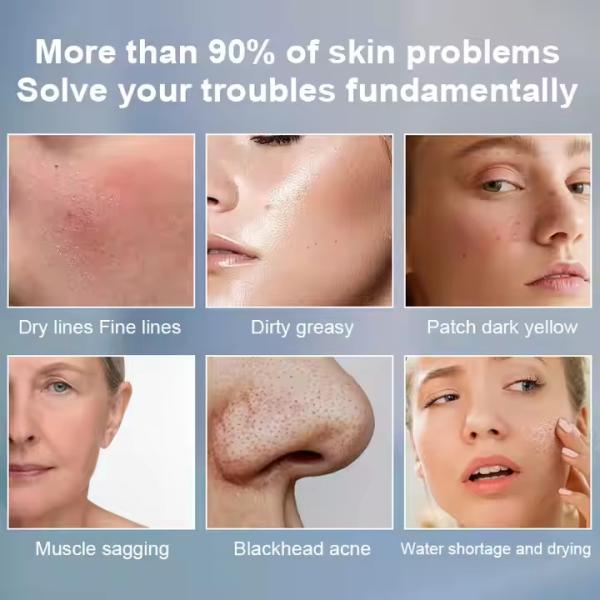 NIR Milk Light Whitening Ice 808nm Diode Laser Device 4 Wavelength 755 808 940 1064 Diode Laser Hair Removal Machine