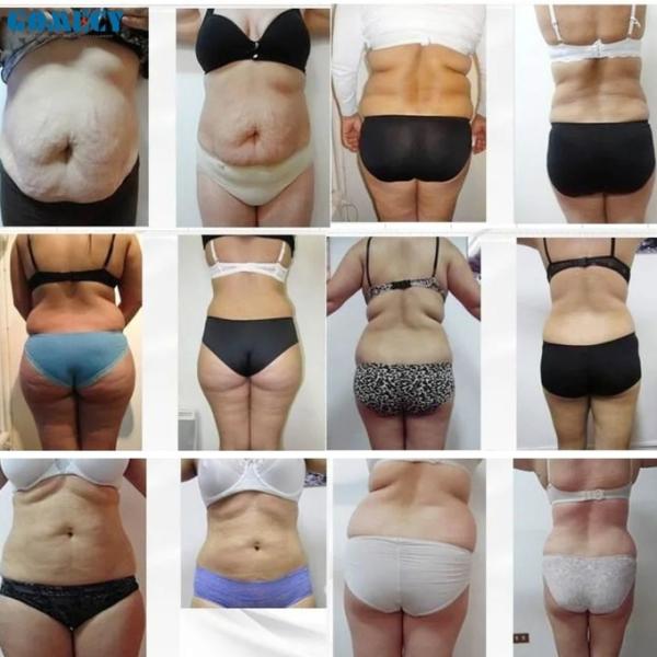 2025 Forma corporal 6D Lipo Máquina de adelgazamiento con láser Eliminación de grasas 635 Perdida de peso delgada