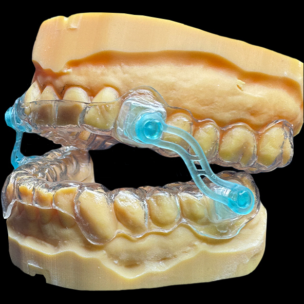 Dental Lab Outsourcing | Anti Snoring Device Dental Occlusal Splint Clear Color Non Invasive
