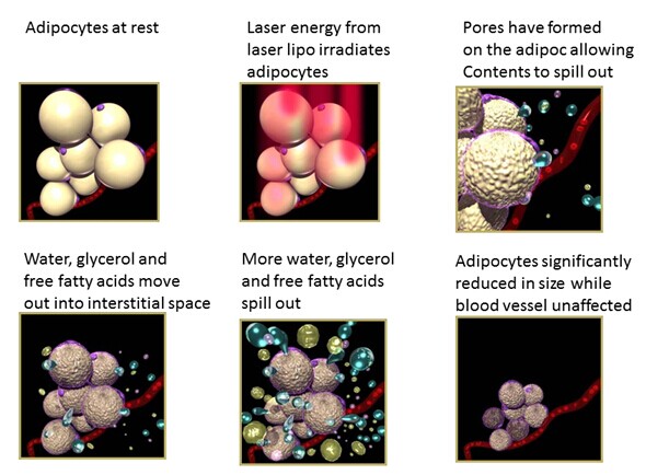 12 пусковых площадок 336 машин для лазерной терапии диодов портативная машина для похудения липолазерного тела