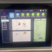 Machine de tri du noyau à base de noyau alimentée par l'IA Stabilité de qualité industrielle Surveillance en temps réel pour le traitement intelligent des noix